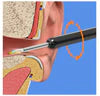 Earwax Removal Kit – Smart Visual Earwax Removal Tool 👂📱