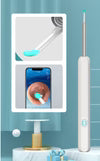 Earwax Removal Kit – Smart Visual Earwax Removal Tool 👂📱