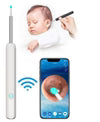 Earwax Removal Kit – Smart Visual Earwax Removal Tool 👂📱